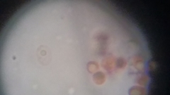 Fuscoporia ferruginosa