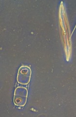 Stephanopyxis palmeriana