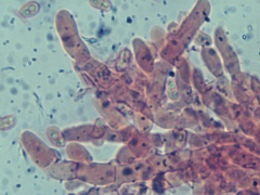 Hyphoderma