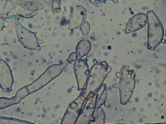 Botryobasidium conspersum