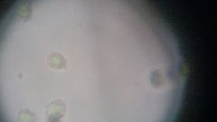 Trechispora mollusca