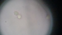 Trechispora mollusca