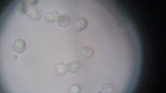 Trechispora mollusca