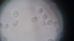 Trechispora mollusca