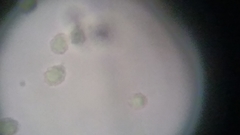 Trechispora mollusca