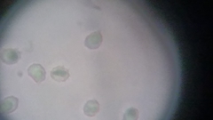 Trechispora mollusca