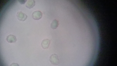 Trechispora mollusca