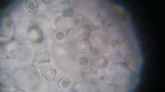 Trechispora mollusca