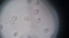 Trechispora mollusca