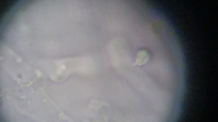 Trechispora mollusca