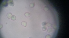 Trechispora mollusca