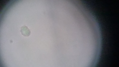 Trechispora mollusca