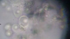 Trechispora mollusca