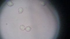 Trechispora mollusca