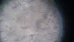 Trechispora mollusca