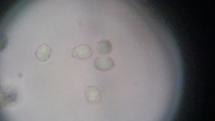 Trechispora mollusca