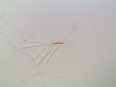 Phialocephala oblonga