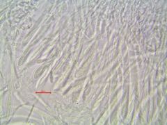 Phialocephala oblonga