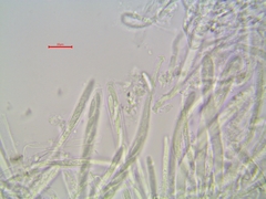 Phialocephala oblonga