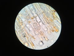 Ramsbottomia crechqueraultii