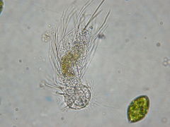 Gastrotricha