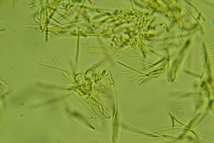 Arachnopeziza aurelia