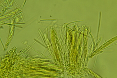 Arachnopeziza aurelia