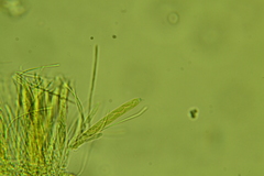 Arachnopeziza aurelia