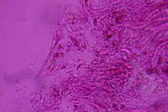 Claussenomyces olivaceus