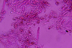 Claussenomyces olivaceus