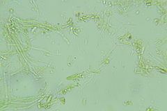Claussenomyces olivaceus