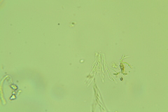 Claussenomyces olivaceus