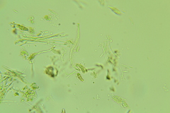 Claussenomyces olivaceus