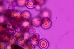 Sphaerosporium lignatile