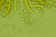 Lasiobolus intermedius