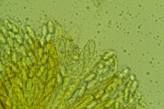 Lasiobolus intermedius