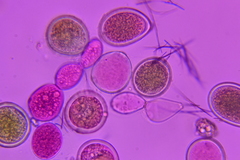 Sphaerosporium lignatile