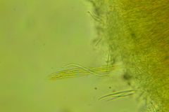 Coccomyces triangularis