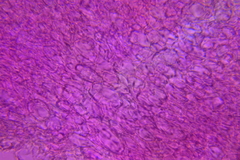 Britzelmayria multipedata