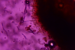 Melanconium stromaticum