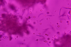 Nidularia deformis