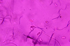 Dacrymyces minor