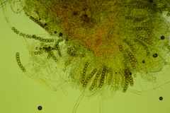 Octospora tuberculata