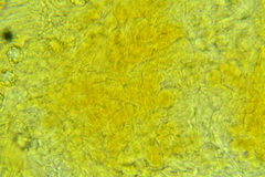 Octospora tuberculata