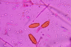 Hypomyces chlorinigenus