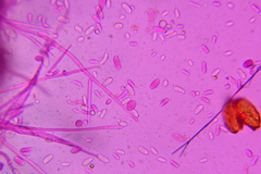 Hypomyces chlorinigenus