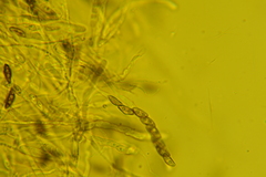 Hypoxylon crocopeplum