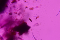 Hypoxylon crocopeplum