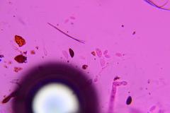 Hypoxylon crocopeplum