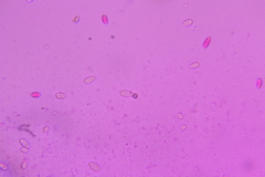 Mycogone calospora